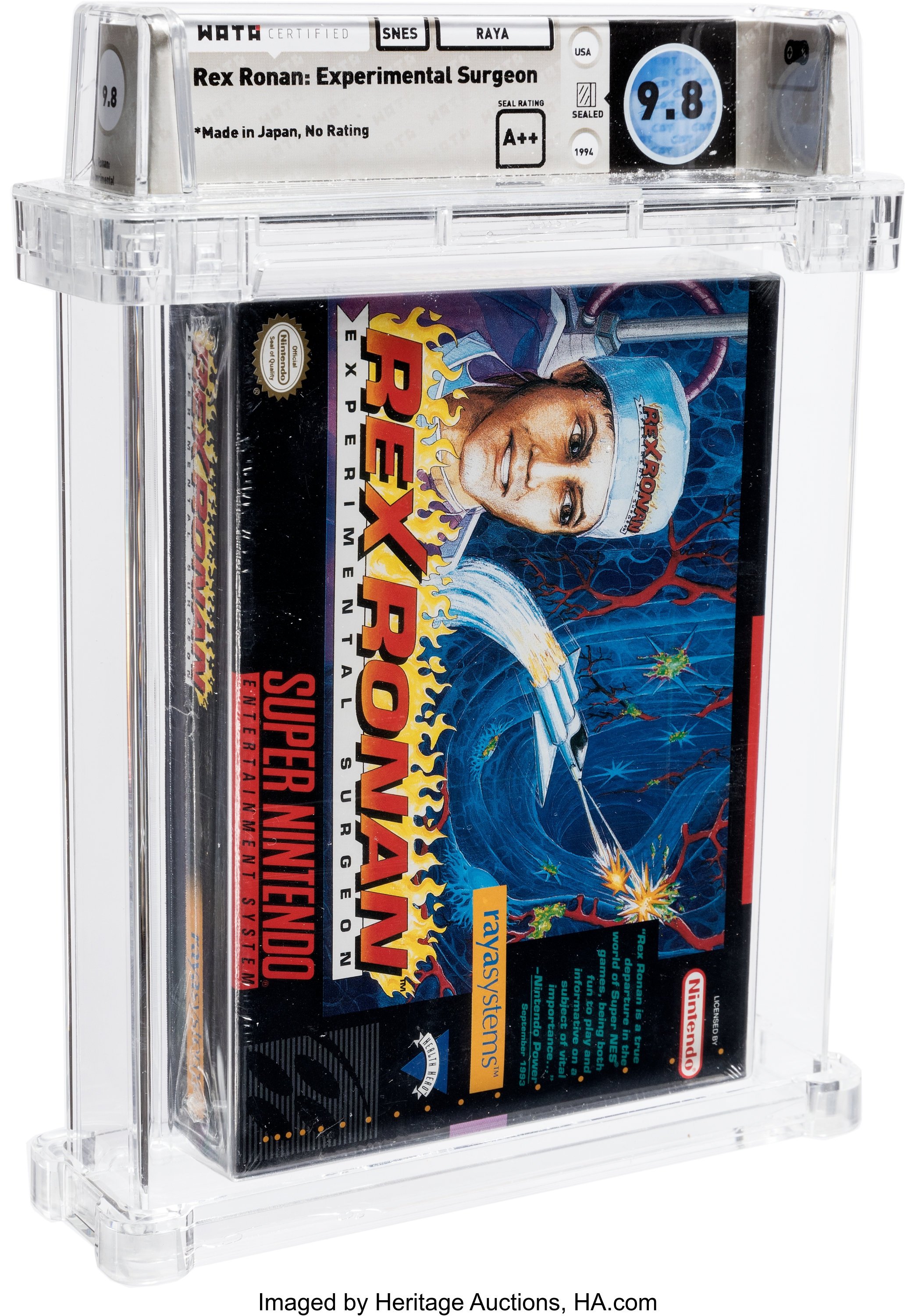 Rex Ronan: Experimental Surgeon Super Nintendo (SNES): PSA Pop Report + Loose / CIB / Sealed Prices 2026